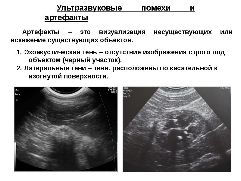 Изображение при узи получают