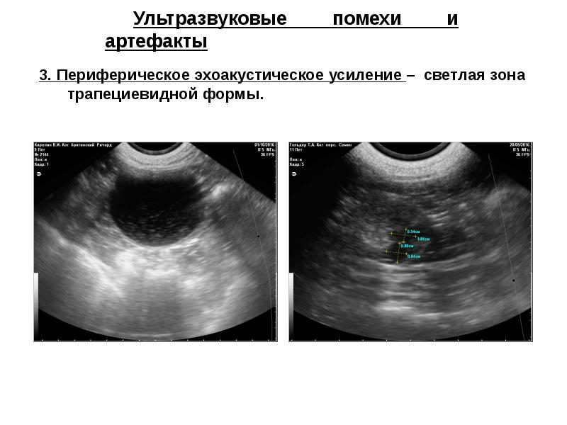 Принцип УЗИ. УЗИ презентация. Физические основы УЗИ. Принцип анализа УЗИ.