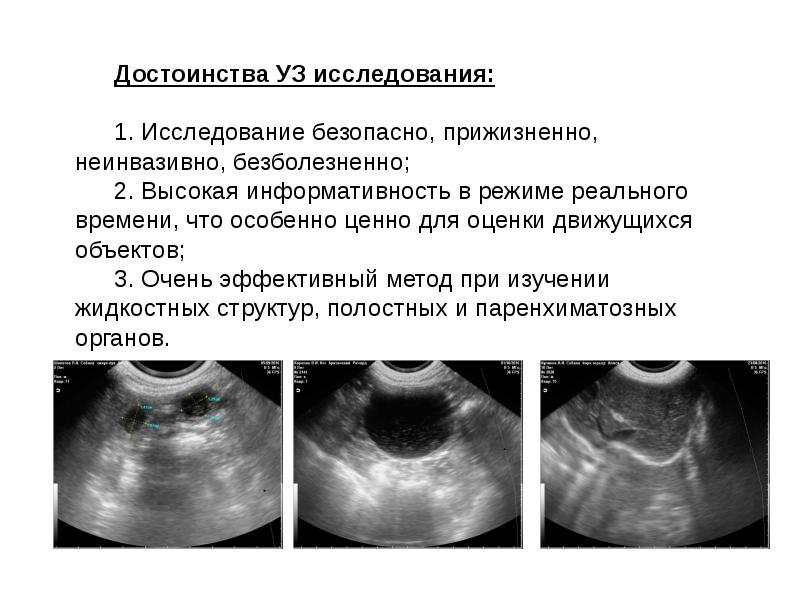 Узи презентация в медицине