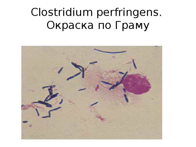 Lachnobacterium spp. Lachnobacterium spp