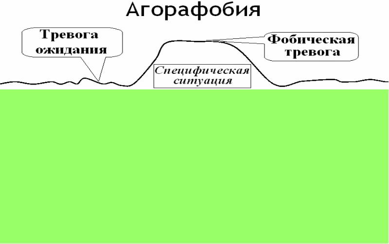 Агорафобия это. Агорафобия симптомы. Степени агорафобии. Агорафобия это в психологии. Агорафобия стадии.