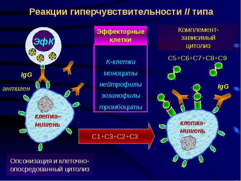 Схема гиперчувствительности 2 типа