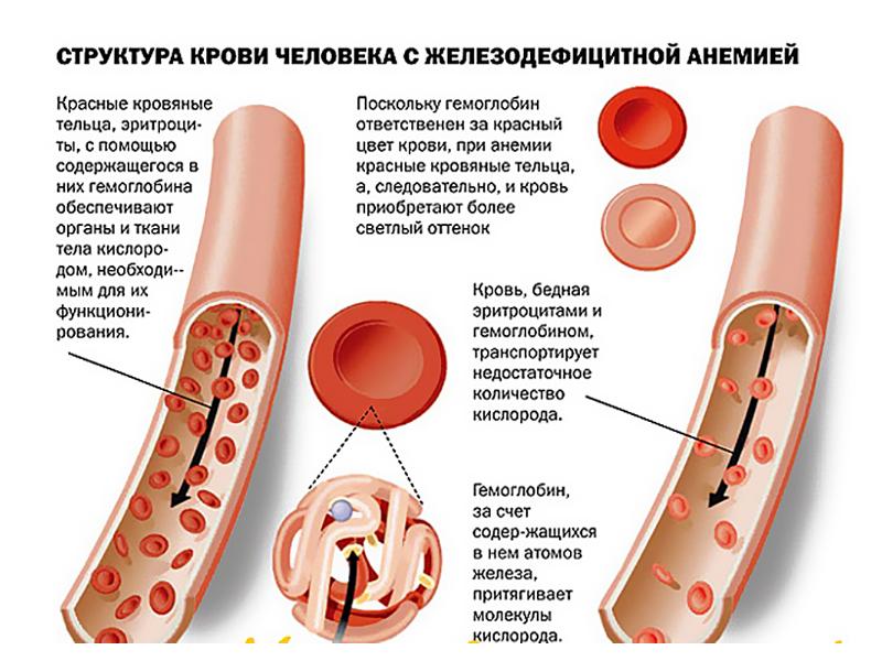 Презентация на тему анемия и лейкоз