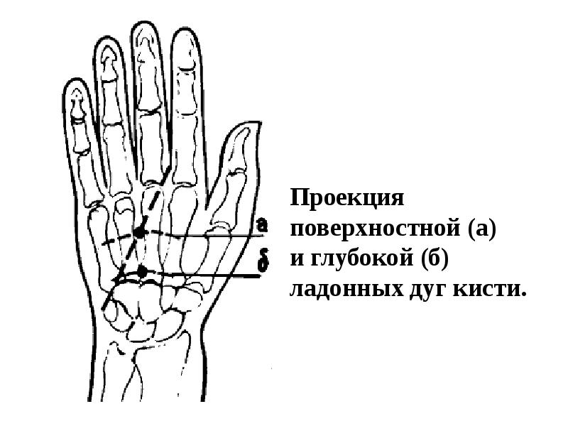 Топографическая анатомия кисти презентация