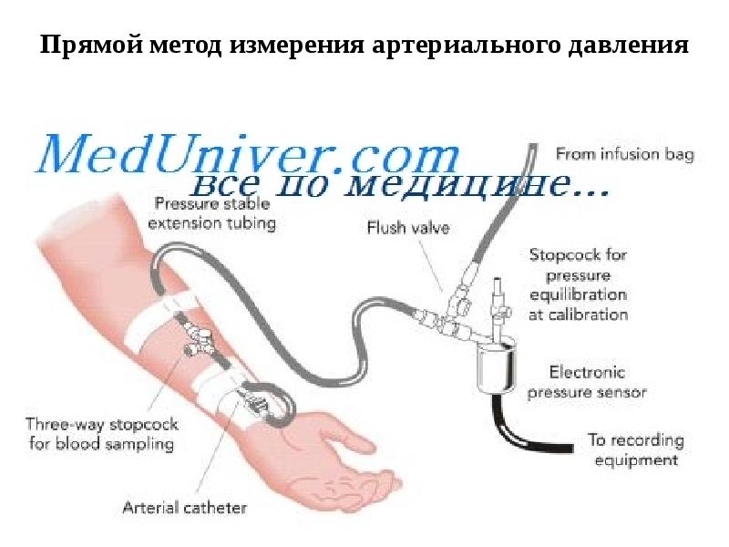 Алгоритм измерения ад. Прямой метод измерения артериального давления. Инвазивное измерение артериального давления. Инвазивное артериальное давление методика измерения. Инвазивный (прямой) метод измерения ад.