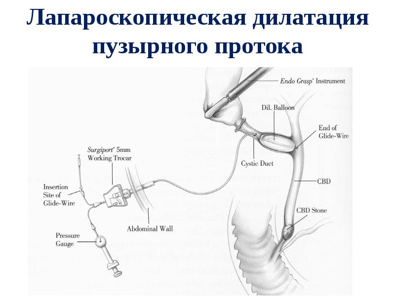 Презентация операции на поджелудочной железе