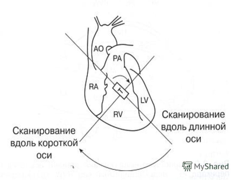 Сегменты сердца на узи схема