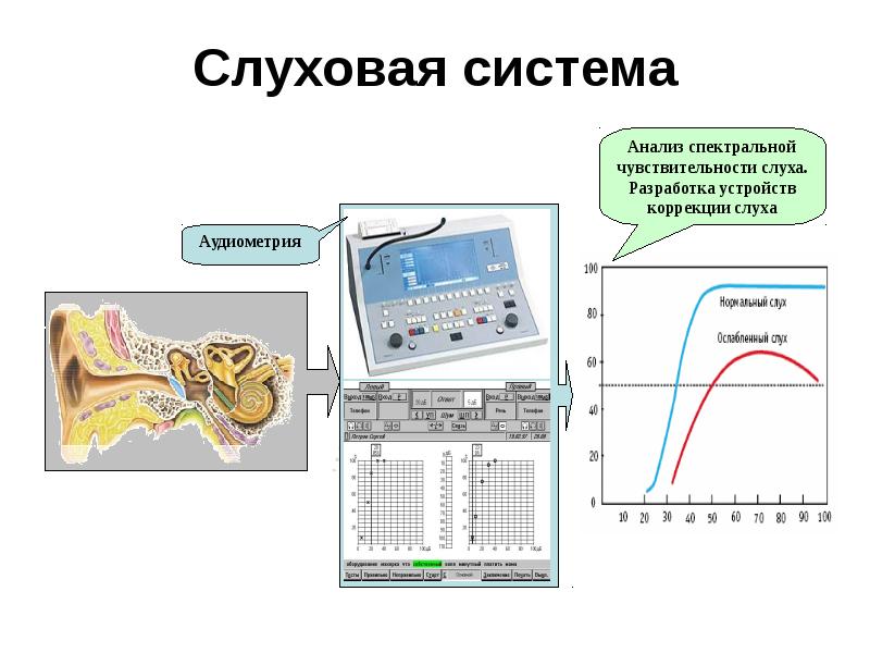 Система слуха