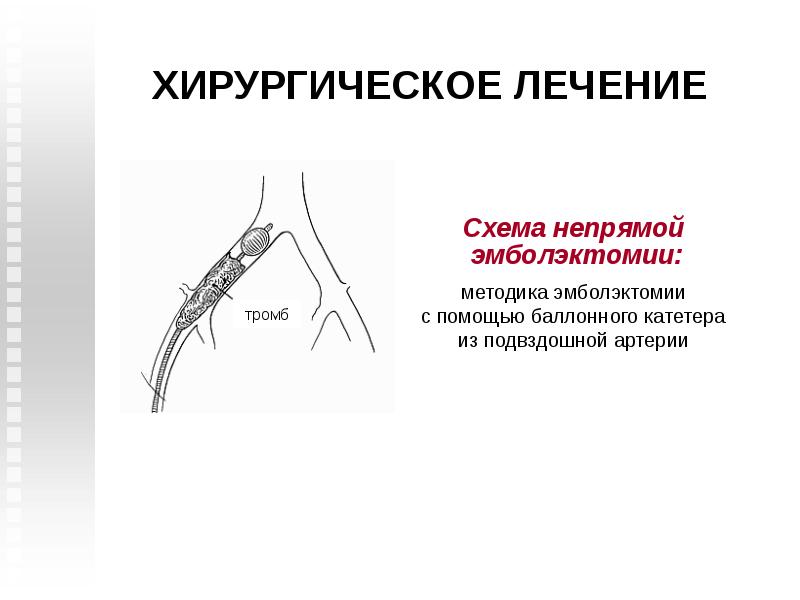 Тромбоз артерий верхних конечностей карта вызова