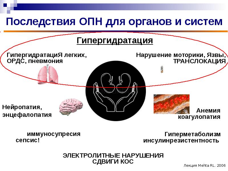 Острое повреждение почек у детей презентация