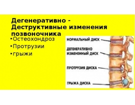 Деструктивно дегенеративные изменения