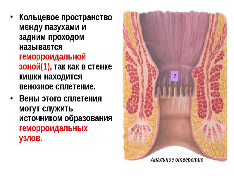 Анальные Сосочки