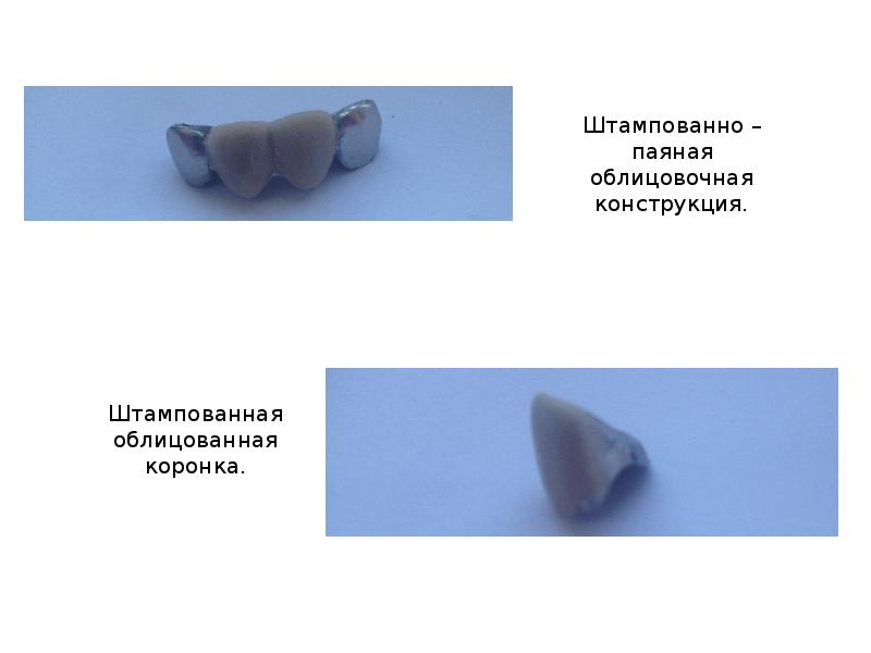 Пластиночные протезы презентация