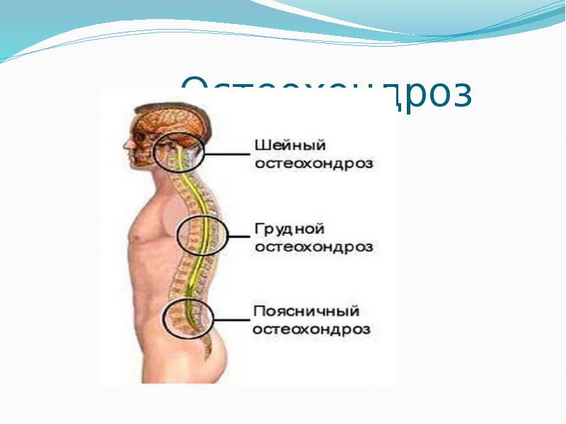 Грыжа казакша презентация