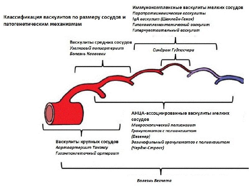 Классификация системных васкулитов презентация