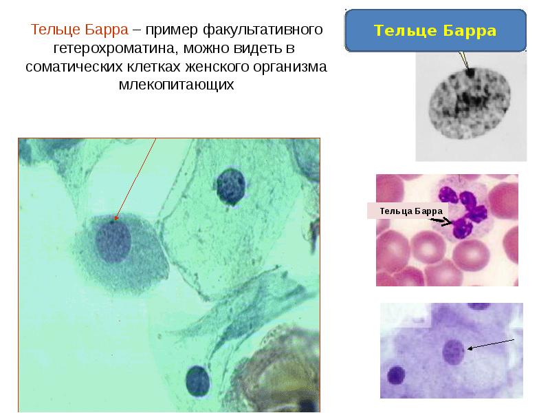 Барра форум. Клетка с тельцами Барра. Тельце Барра микрофотография. Тельце Барра препарат гистология. Тельца Барра в соматических клетках.