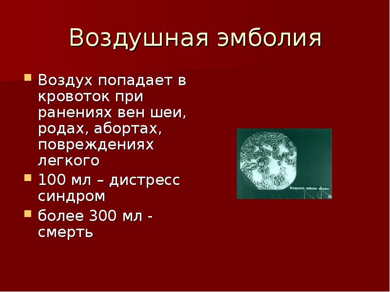 Признаки воздушной эмболии. Воздушная тромбоэмболия. Воздушная эмболия проявления. Клинические проявления воздушной эмболии.