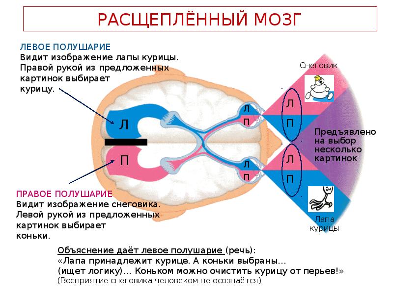 Как видеть мозгом. Синдром расщепленного мозга. Модель расщепленного мозга. Операция по расщеплению мозга. Левое и правое полушарие мозга.