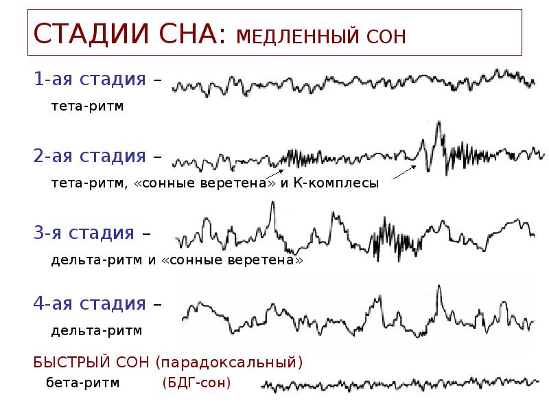 Нарисовать схему стадий сна по данным ээг