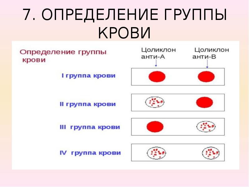 Цоликлоны определить группу. Определение группы крови. Определение группы крови человека. Определение группы крови цоликлонами. Группа крови Цоликлоны.