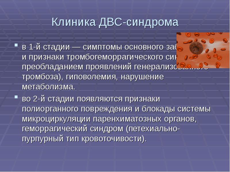 Двс синдром презентация