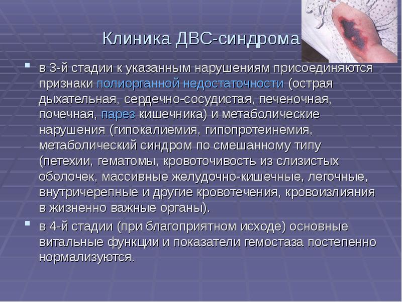 Двс синдромы презентация казакша