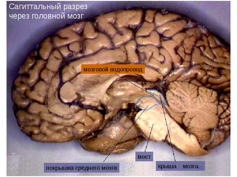 Ствол головного мозга фото