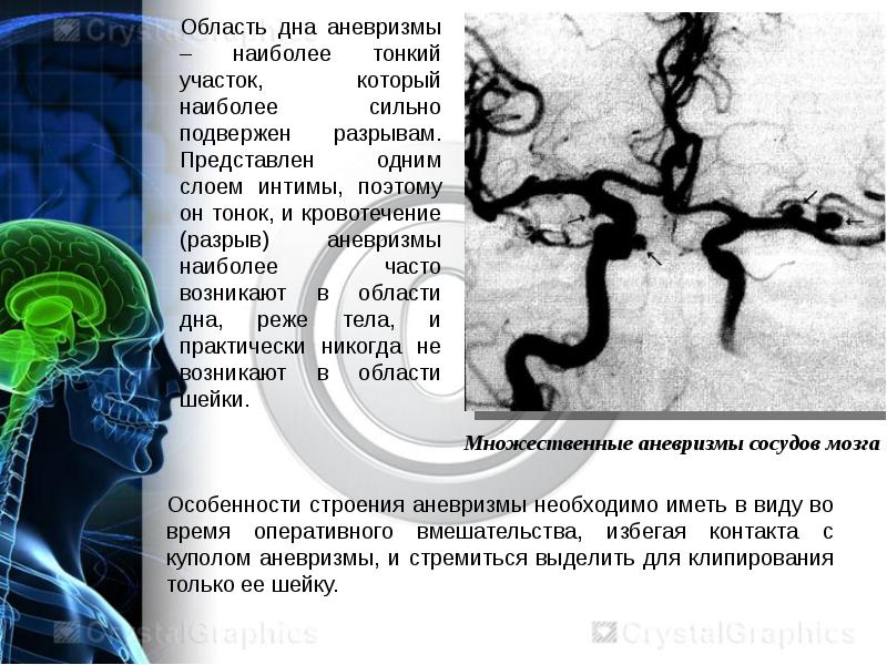 Аневризма сосудов головного мозга презентация