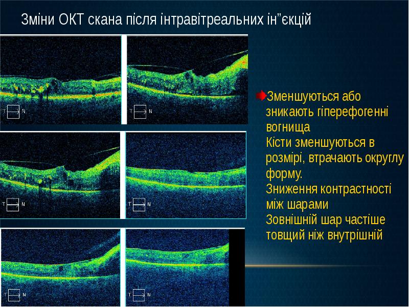 Оптическая когерентная томография схема