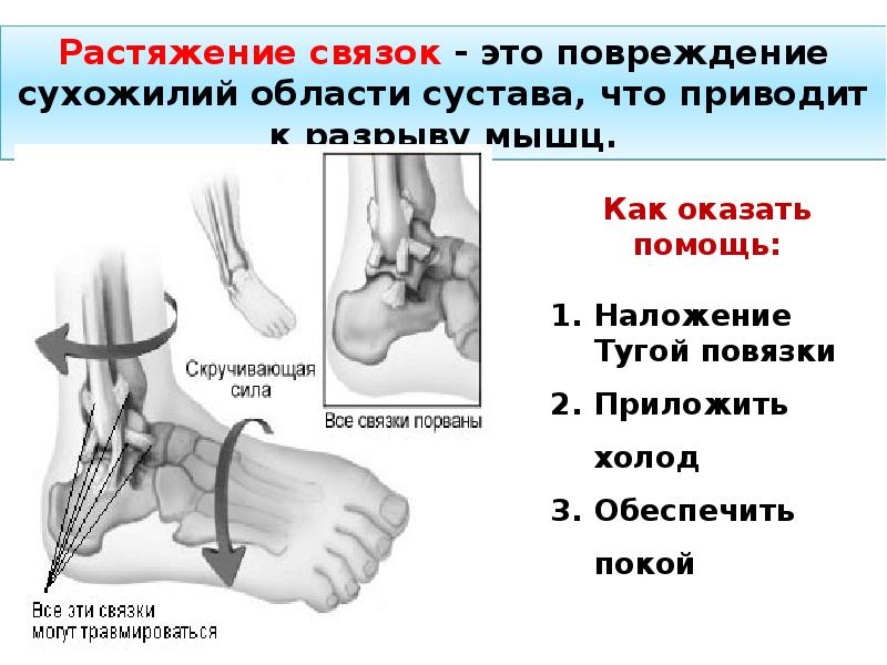 Переломы и вывихи общая хирургия презентация