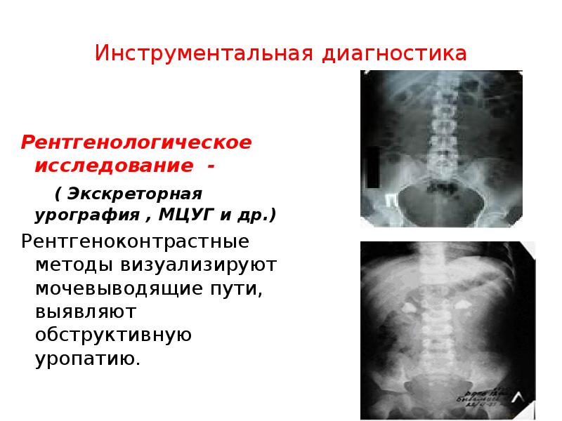 Экскреторная урография рентгенологическое исследование почек относится к функциональным изображениям