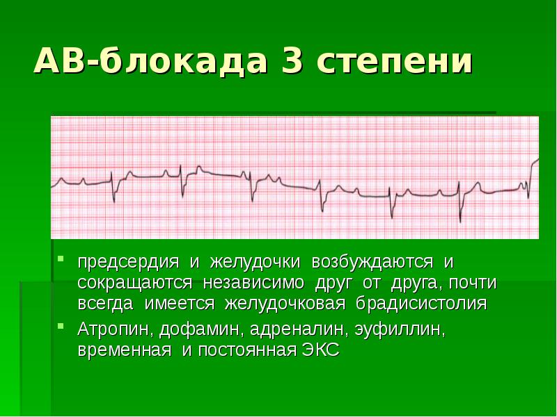 Нарушение ритма и проводимости сердца презентация