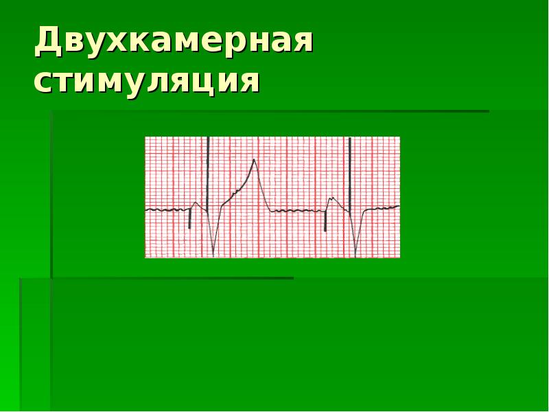 Воспроизведение ритмов по слуховому образцу