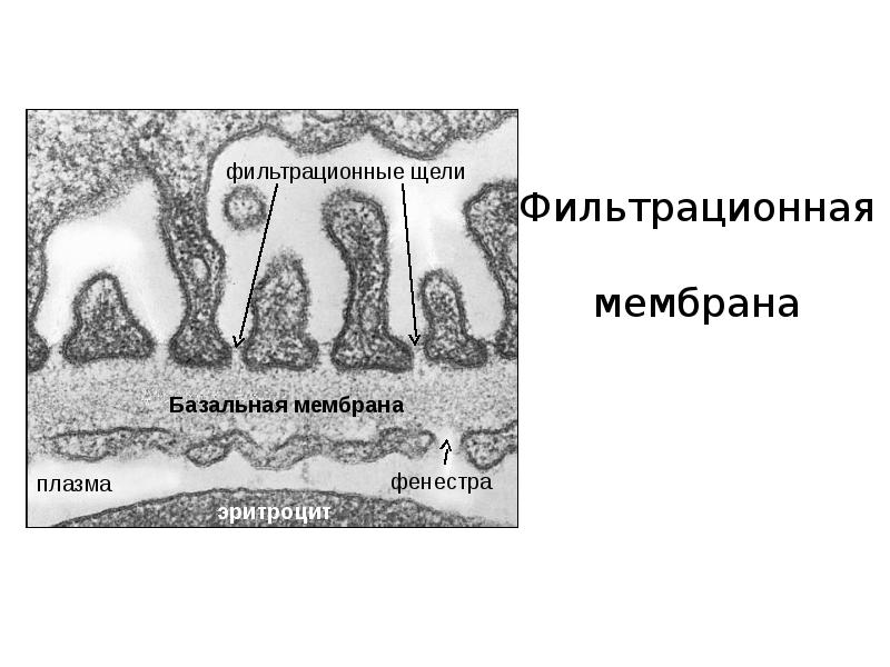 Фильтрационная мембрана почки схема