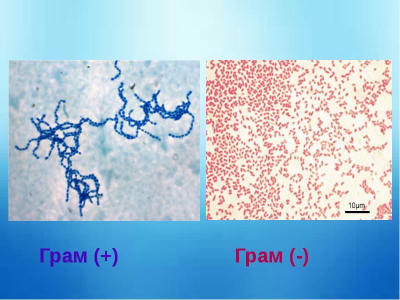 Грамм бактерии. Грамположительные бактерии. Грамположительные и грамотрицательные бактерии окраска. Грамотрицательные микроорганизмы. Классификация микроорганизмов по грамму.