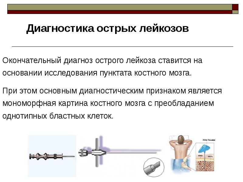 При наличии какого. Острый лейкоз диагностика. Диагноз острый лейкоз. Методы исследования при остром лейкозе. Окончательный диагноз острого лейкоза ставится на основании.