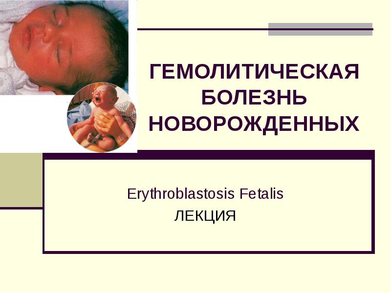 Реферат: Гемолитическая болезнь новорожденных