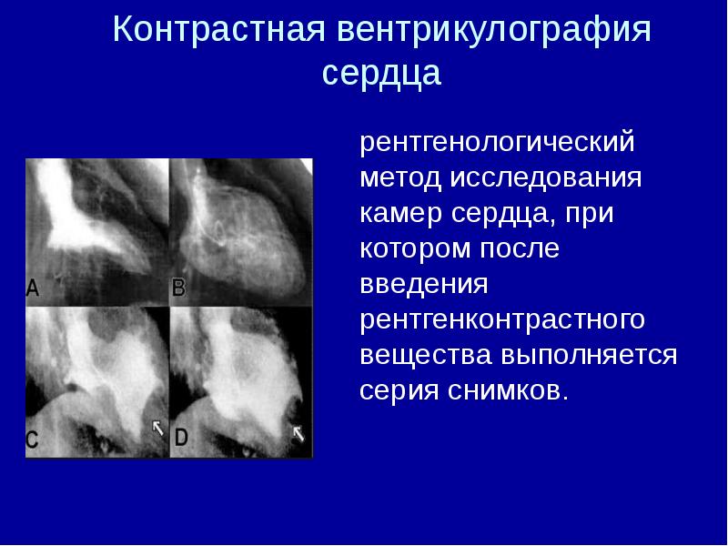 Контрастное исследование. Рентгенологические методы исследования сердца. Рентгенологический метод исследования сердца. Рентгенологические контрастные методы исследования. Рентгенологические методы исследования сердечно-сосудистой системы.