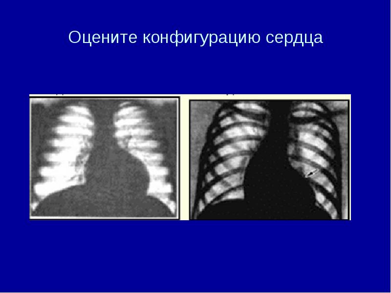 Лучевая диагностика сердечно сосудистой системы презентация