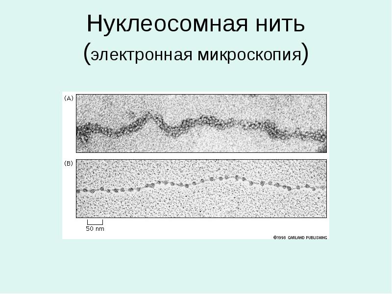 Нуклеосомная нить (электронная микроскопия) Нуклеосомная нить (электронная микроскопия)