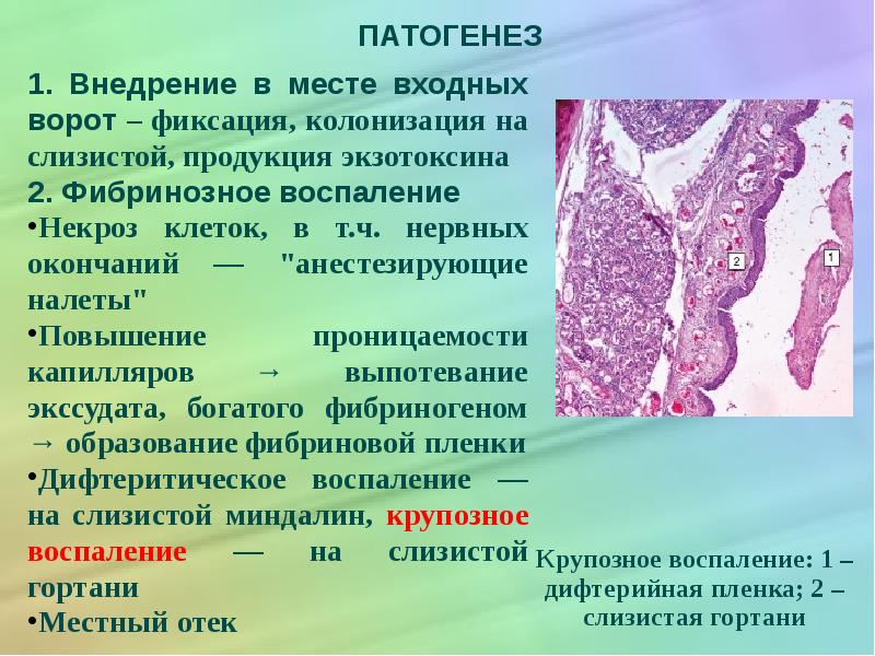 Патогенез скарлатины схема