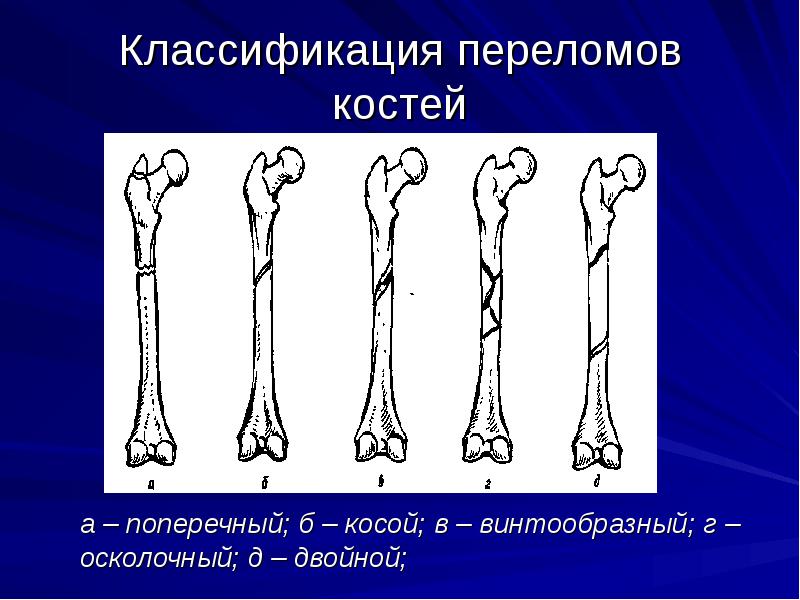 Вывихи травматология презентация