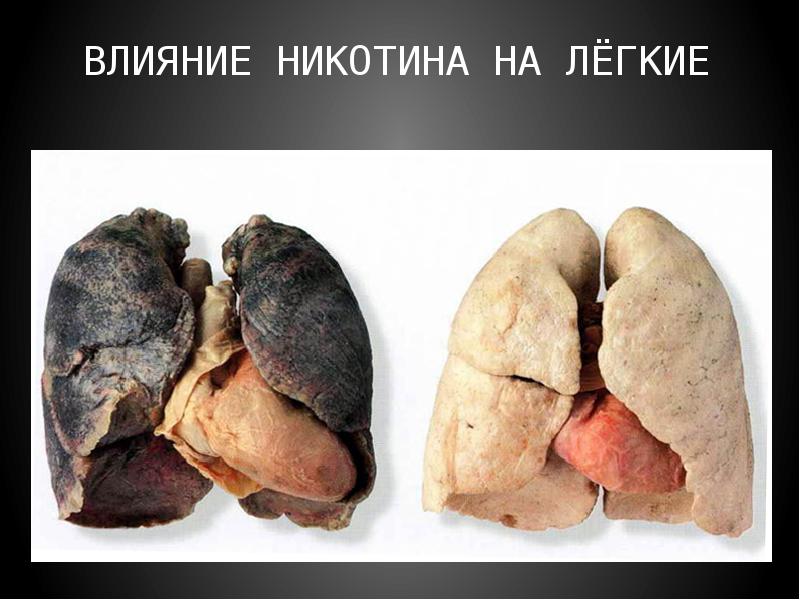 Доклад Вред Курения Для Организма