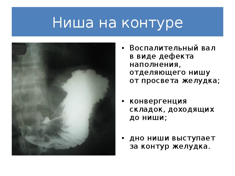 Бариевая комната это