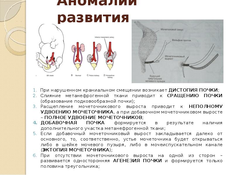 Аномалии развития мочеиспускательного канала презентация