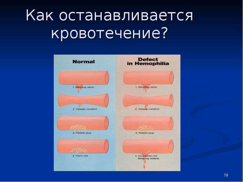 Геморрагический диатез. Патогенез кровотечения при гемофилии а. Геморрагический диатез на коже. Геморрагический диатез гемофилия. Геморрагические диатезы ногти.