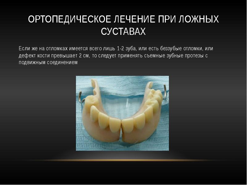 Ортопедическое лечение переломов нижней челюсти презентация