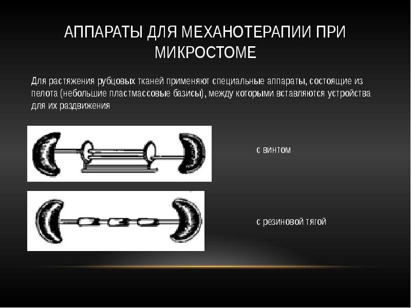 Микростомия этиология клиническая картина ортопедические методы лечения при микростомии