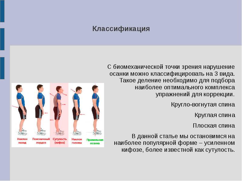 Презентация нарушение осанки