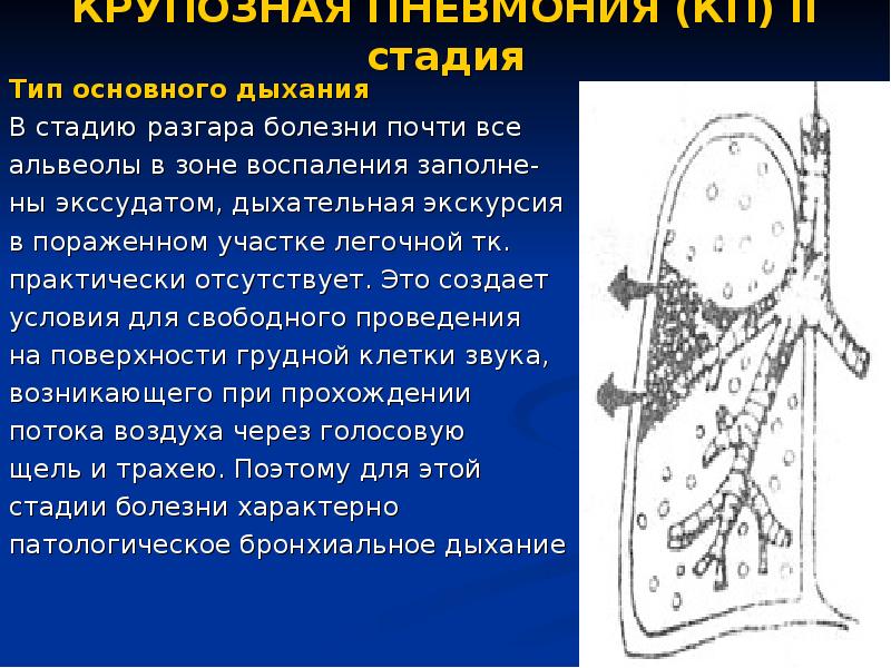 Наиболее возможная аускультативная картина легких при очаговой пневмонии